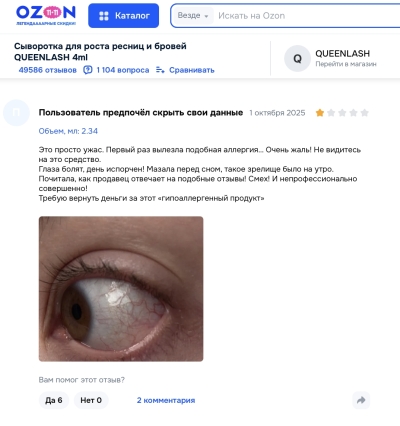 Queenlash отзывы: стоит ли верить обещаниям о густых ресницах?