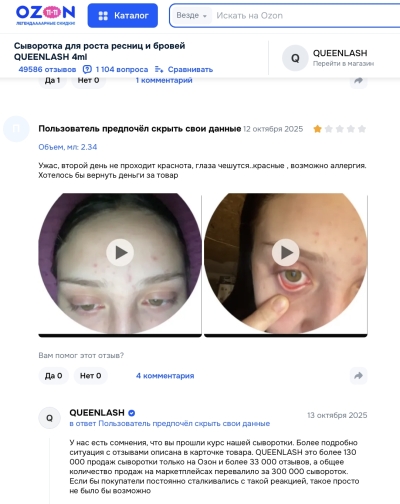 Queenlash отзывы: Почему стоит задуматься о безопасности при выборе сыворотки для роста ресниц